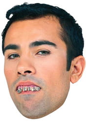 Фото Кривые зубы с брекетами